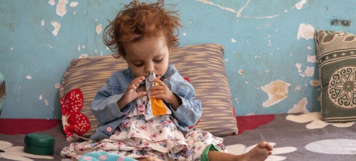 © WFP/Ahmed Basha طفل صغير يتناول مكملا غذائيا في محافظة تعز باليمن.