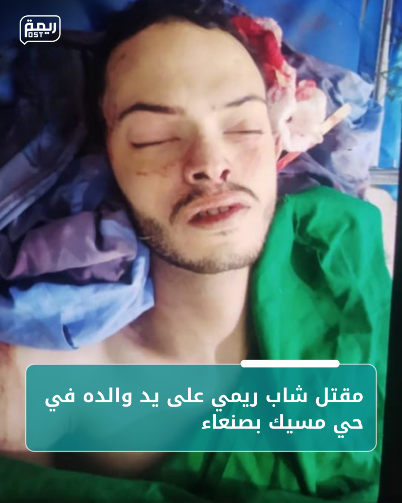 مقتل شاب ريمي على يد والده في صنعاء